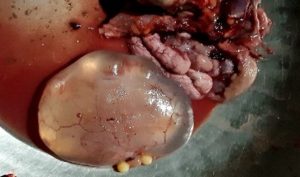 Ovarian Cysts in Chickens